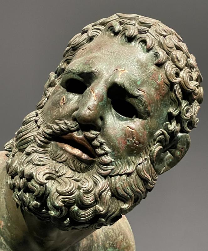 Quirinal Pugilist – detailne vaade peast © Classic Garden Elements 3