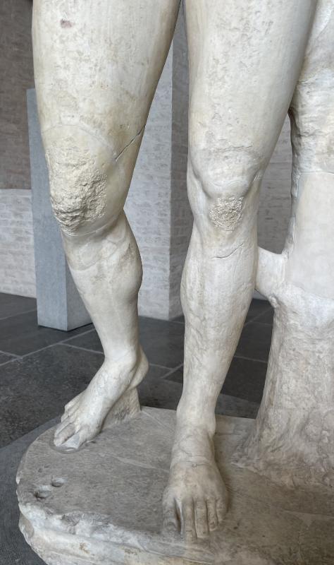 Müncheni kuningas – tugijala ja vabajala üksikasjalikud vaated © Classic Garden Elements (5) Müncheni kuningas – tugijala ja vabajala üksikasjalikud vaated © Classic Garden Elements (5)